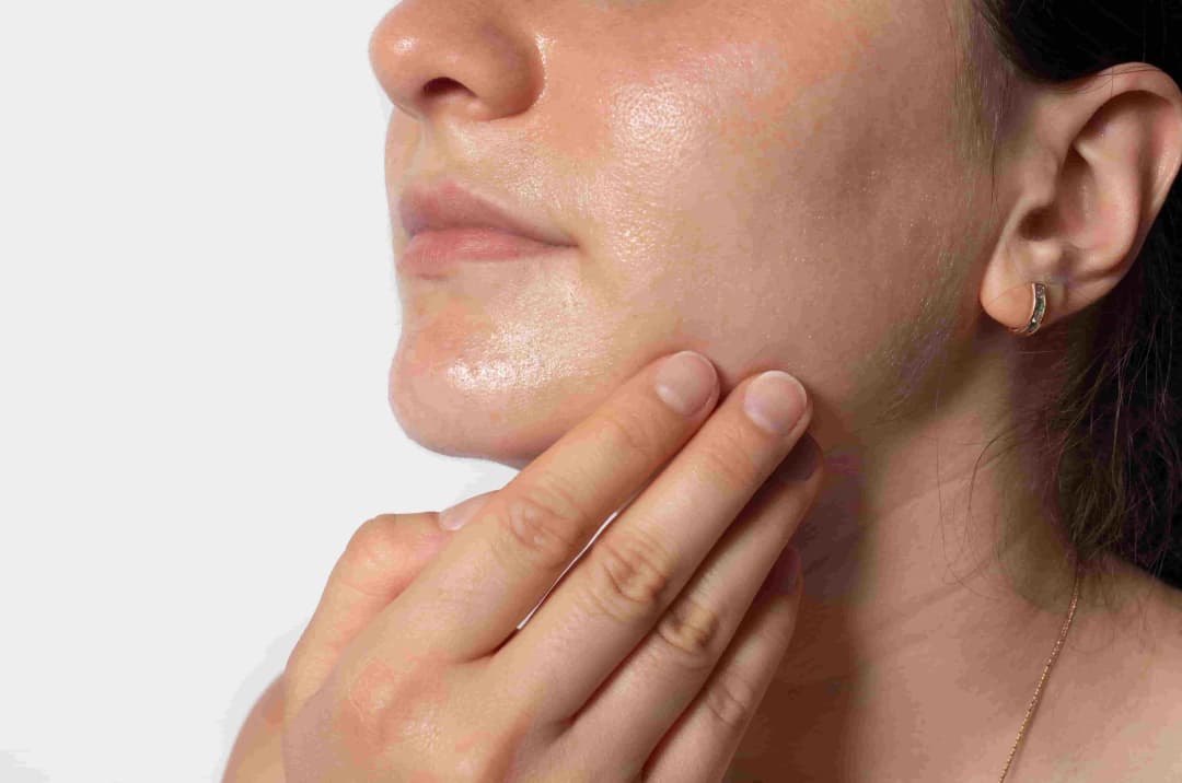 7 Perbedaan Glowing dan Berminyak, Kenali Cirinya di Sini!