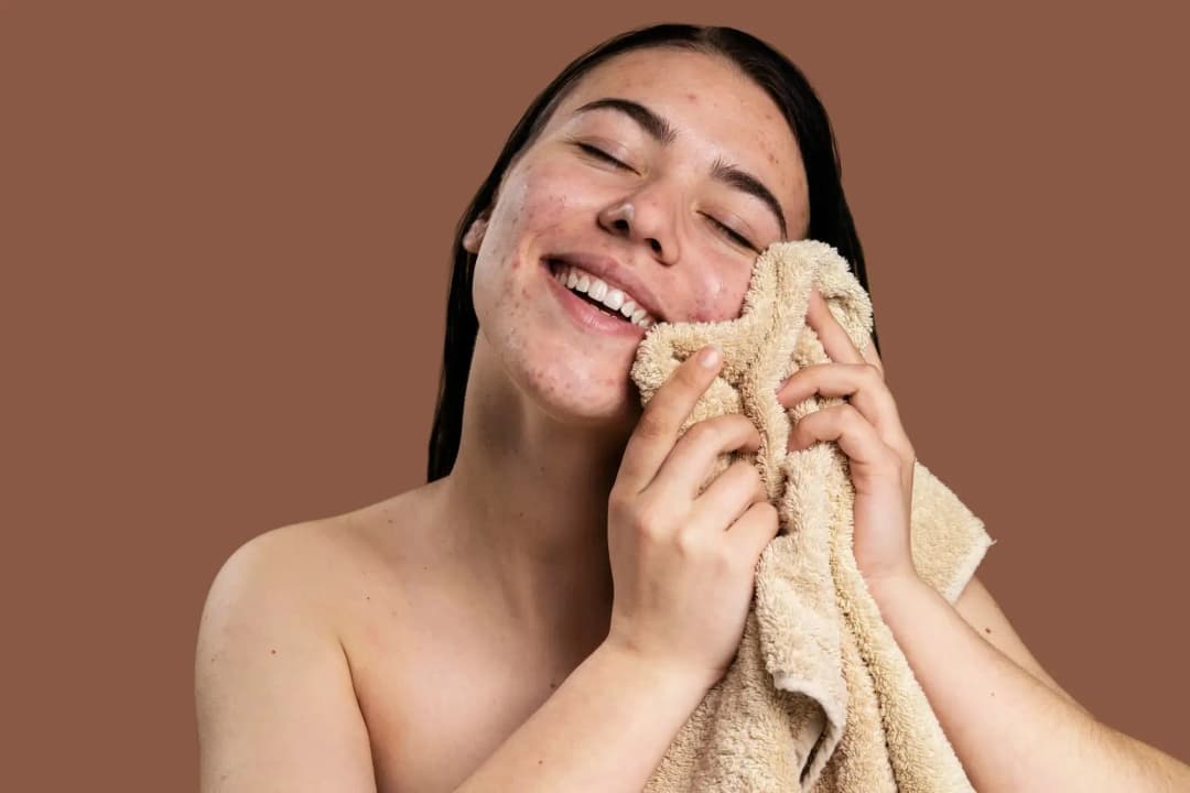 15 Cara Merawat Wajah agar Tidak Berjerawat