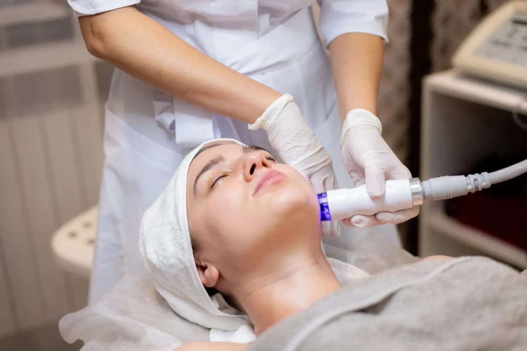 7 Macam-Macam Laser Wajah dan Manfaatnya