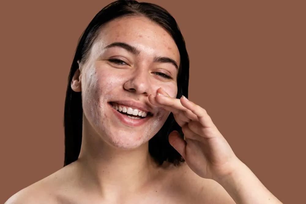 7 Cara Mengatasi Kulit Wajah Kering dan Mengelupas