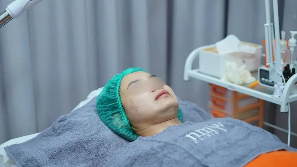5 Manfaat Filler Dagu untuk Membentuk Wajah yang Ideal!
