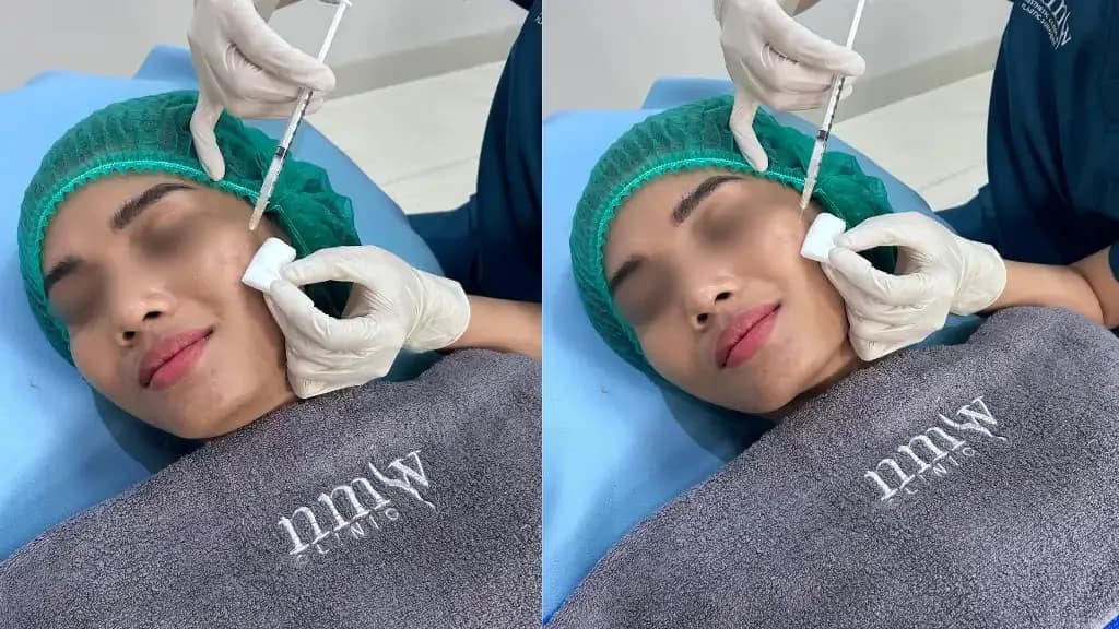 7 Tips Kulit Kencang agar Wajah Kamu Tampak Muda dan Segar