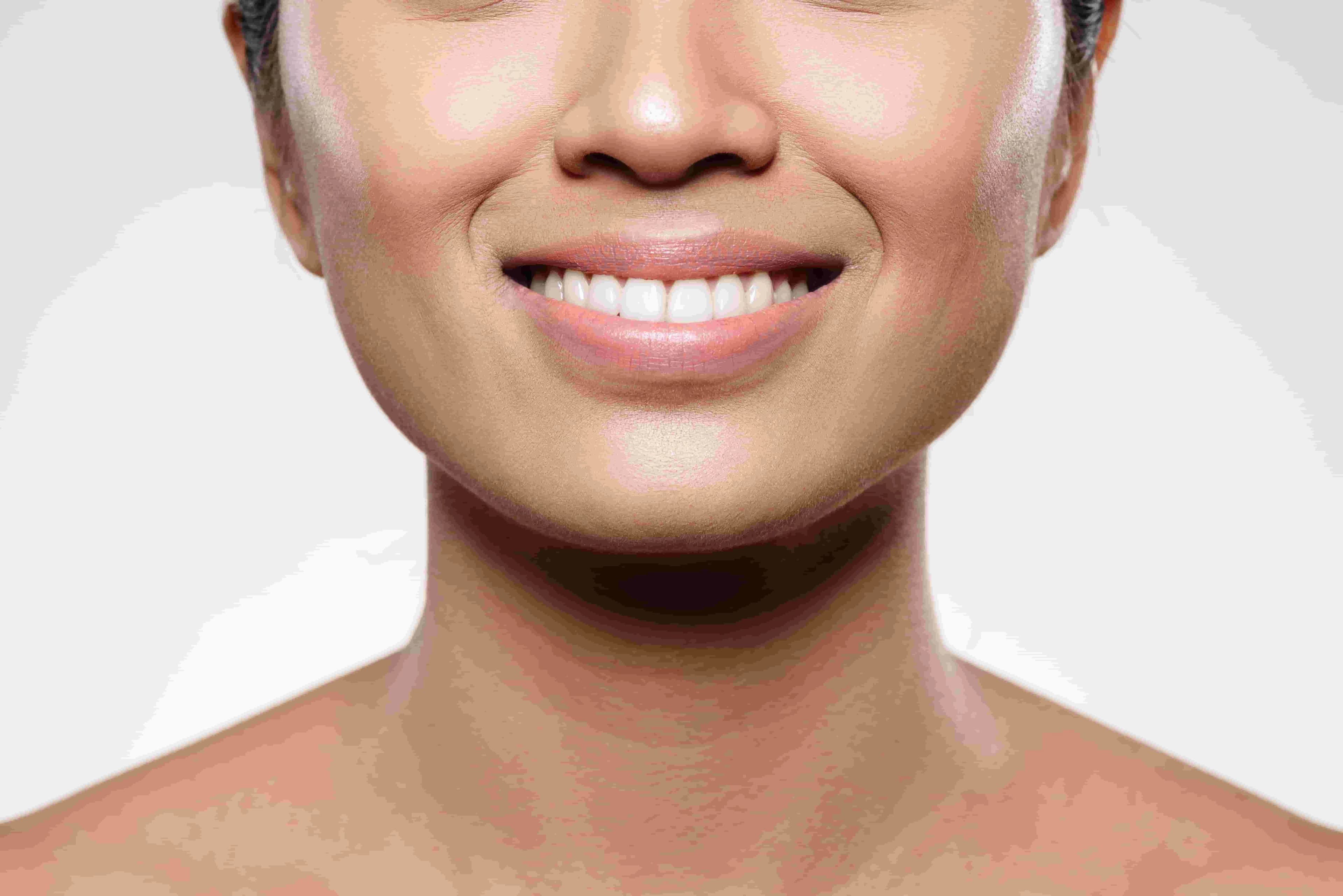 8 Cara Hilangkan Smile Line dan Penyebabnya Secara Efektif