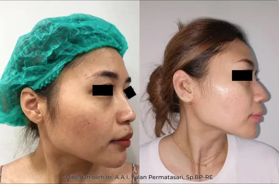 Patient Case #82