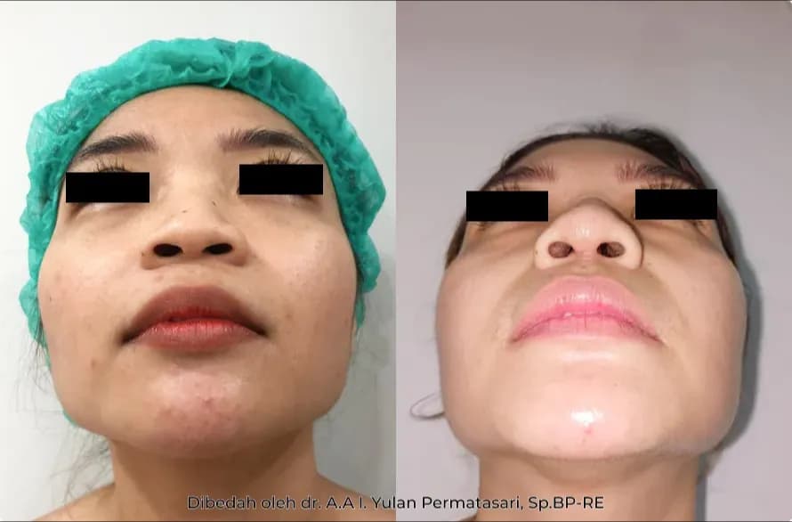 Patient Case #82